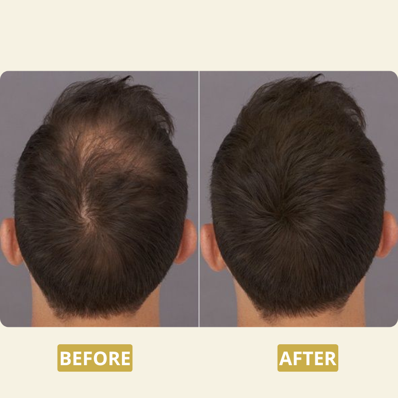 Tritogen™ Root Activator Shampoo For Men Hair Loss