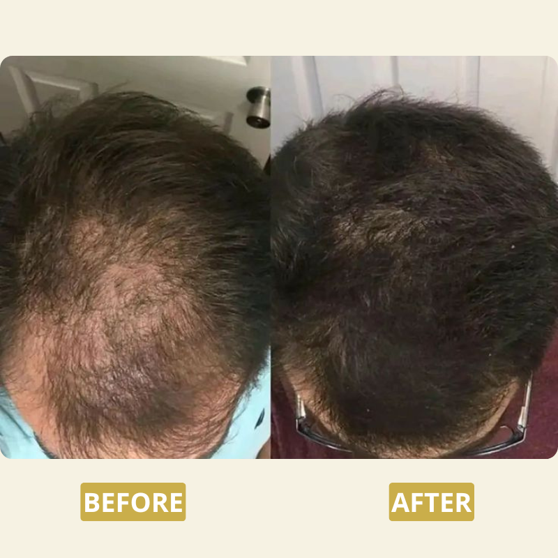 Tritogen™ Root Activator Shampoo For Men Hair Loss